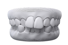 Dentes apinhados
